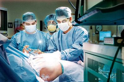 prowadzenie operacji w celu zwiększenia członka